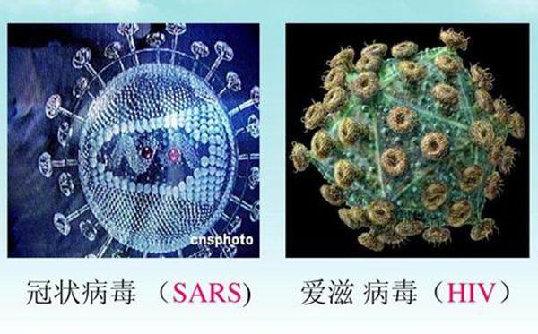 SARS冠状病毒