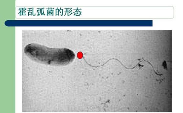 霍乱孤菌的形态